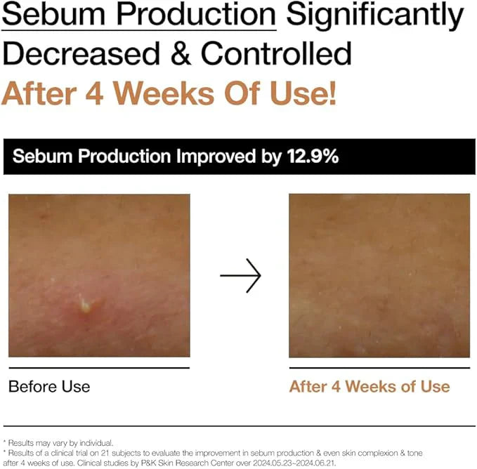 Anua -Rice 70 Glow Milky Toner (Original) | أنيوا هارتليف 70% تونر مهدئ